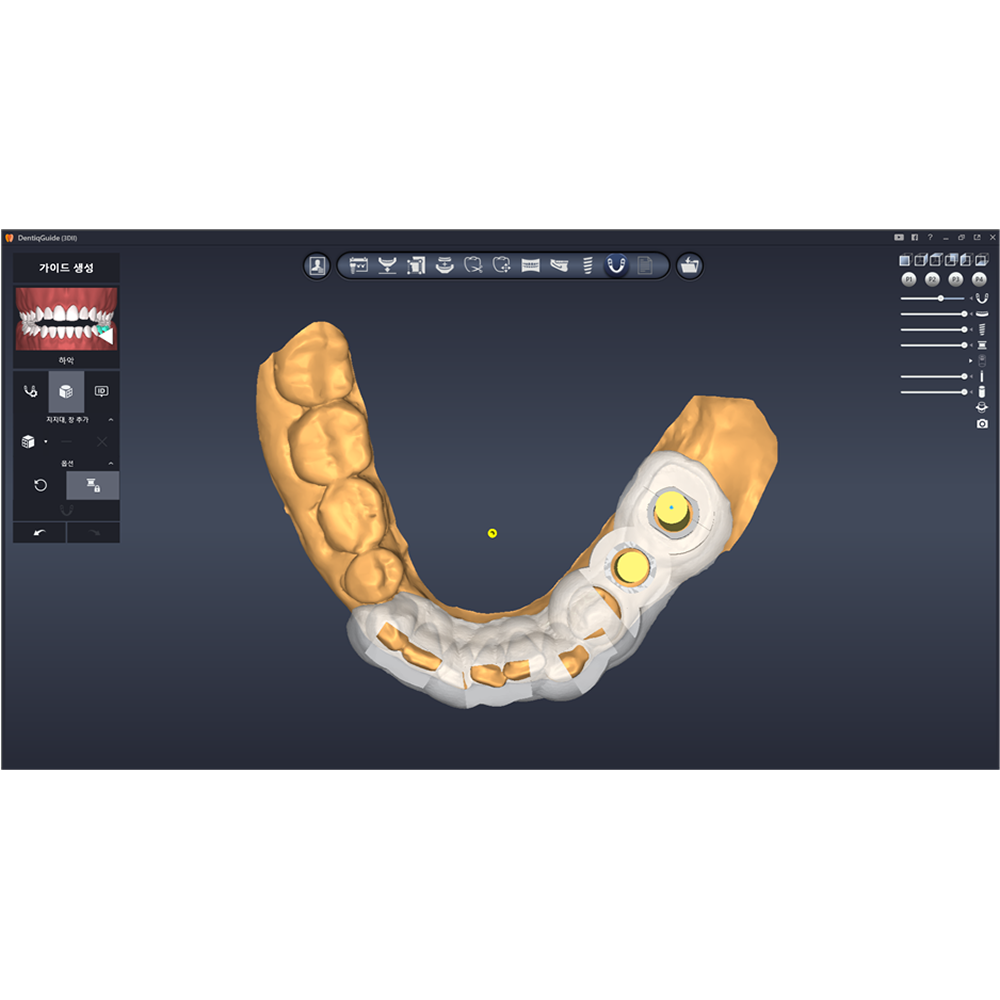[3D Industrial] DentiqGuide