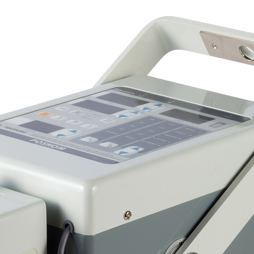 [POSKOM] PXP-100CA : high powered portable x-ray system